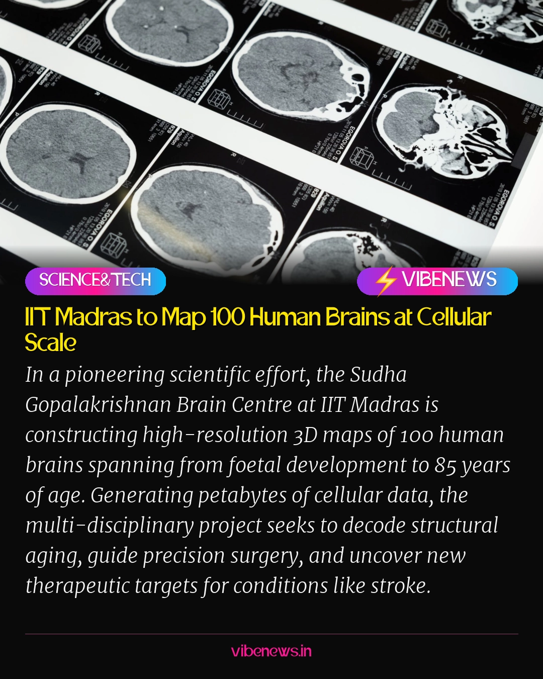 IIT Madras to Map 100 Human Brains at Cellular Scale